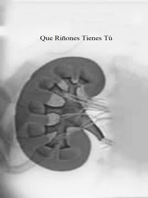 cover image of Que Riñones Tienes Tú